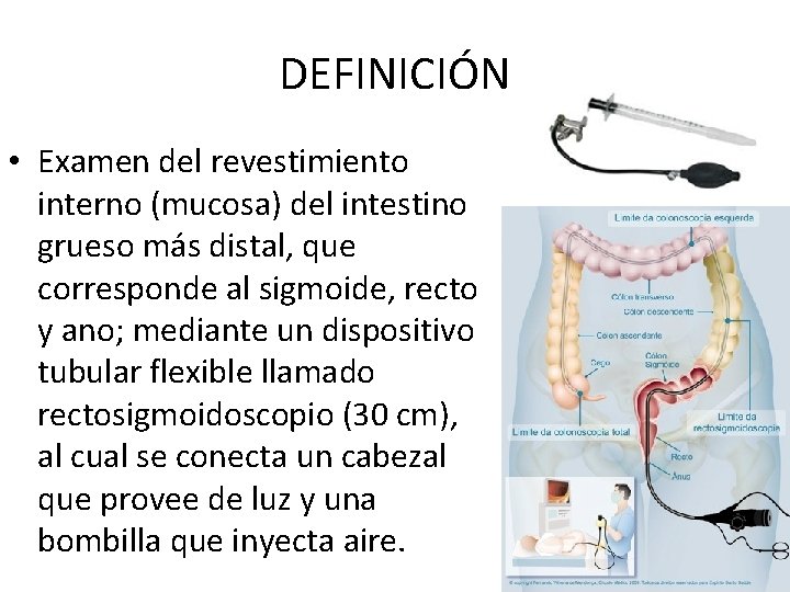 DEFINICIÓN • Examen del revestimiento interno (mucosa) del intestino grueso más distal, que corresponde