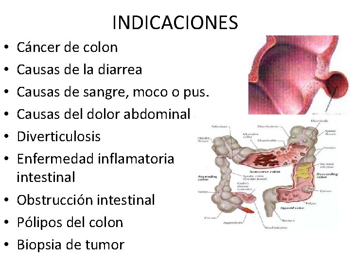 INDICACIONES Cáncer de colon Causas de la diarrea Causas de sangre, moco o pus.