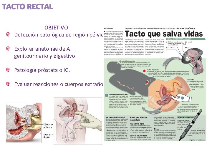 TACTO RECTAL OBJETIVO Detección patológica de región pélvica Explorar anatomía de A. genitourinario y