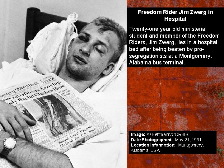 Freedom Rider Jim Zwerg in Hospital Twenty-one year old ministerial student and member of