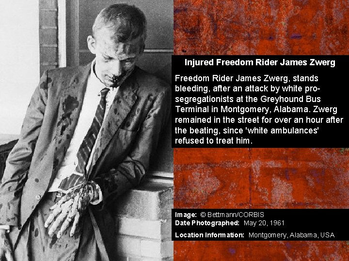 Injured Freedom Rider James Zwerg, stands bleeding, after an attack by white prosegregationists at