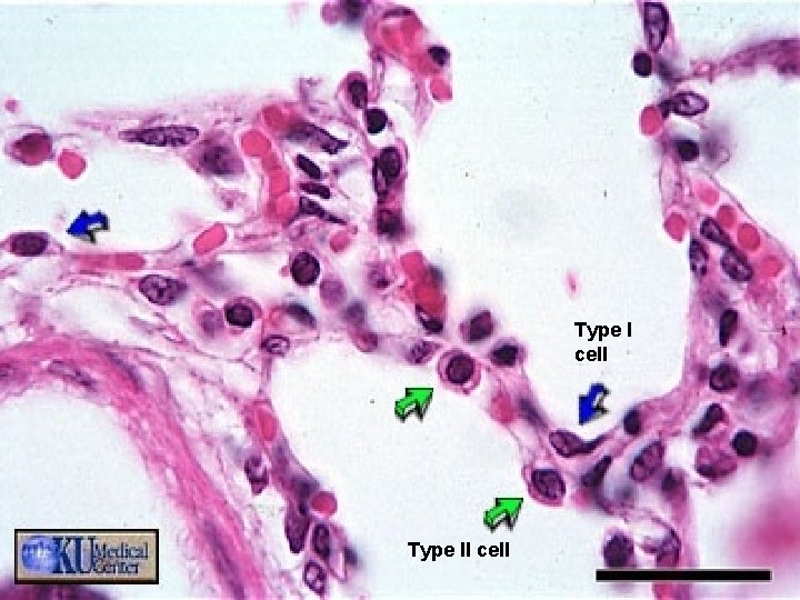 Type I cell Type II cell 