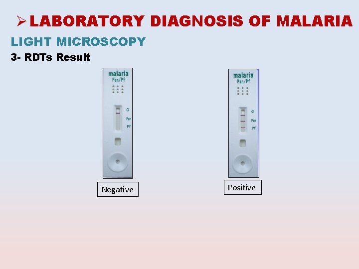Ø LABORATORY DIAGNOSIS OF MALARIA LIGHT MICROSCOPY 3 - RDTs Result Negative Positive 