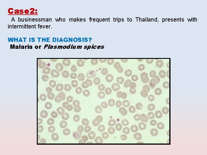 Case 2: A businessman who makes frequent trips to Thailand, presents with intermittent fever.