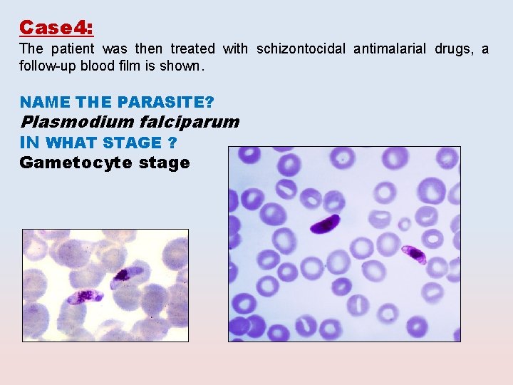 Case 4: The patient was then treated with schizontocidal antimalarial drugs, a follow-up blood