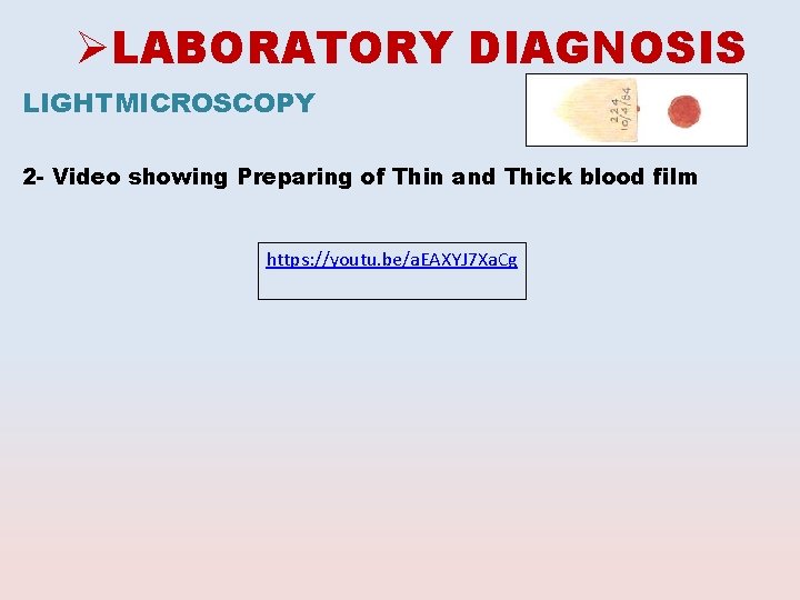 ØLABORATORY DIAGNOSIS LIGHTMICROSCOPY 2 - Video showing Preparing of Thin and Thick blood film