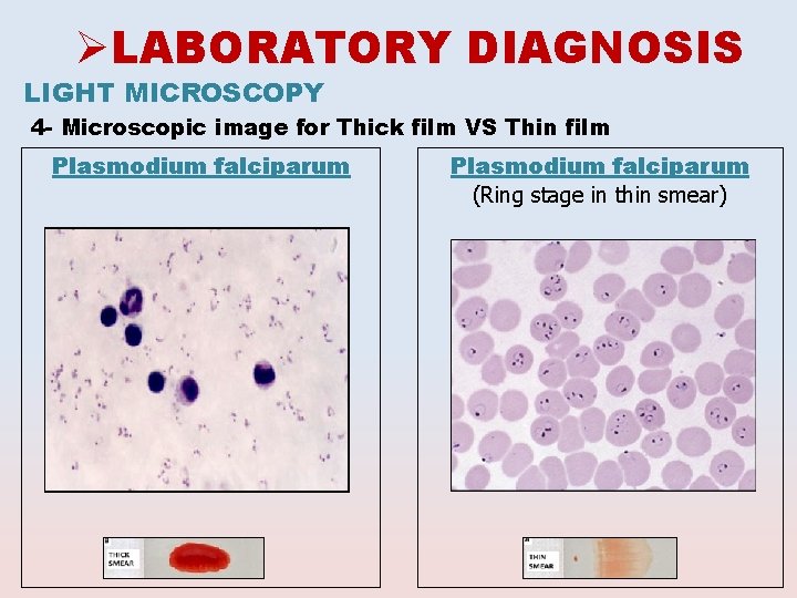 ØLABORATORY DIAGNOSIS LIGHT MICROSCOPY 4 - Microscopic image for Thick film VS Thin film