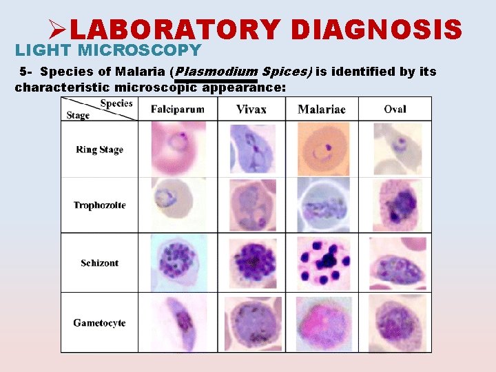 ØLABORATORY DIAGNOSIS LIGHT MICROSCOPY 5 - Species of Malaria (Plasmodium Spices) is identified by