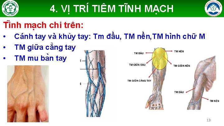 4. VỊ TRÍ TIÊM TĨNH MẠCH Ti nh ma ch chi trên: • •