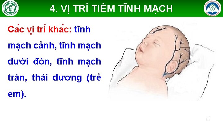 4. VỊ TRÍ TIÊM TĨNH MẠCH Ca c vi tri kha c: tĩnh mạch