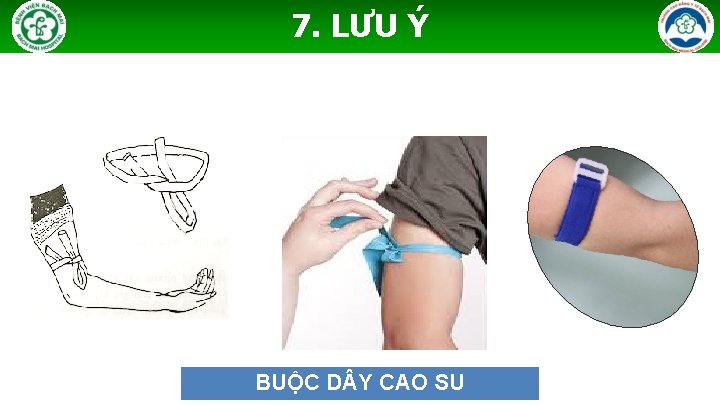 7. LƯU Ý BUỘC D Y CAO SU 