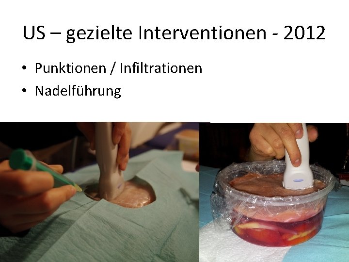 US – gezielte Interventionen - 2012 • Punktionen / Infiltrationen • Nadelführung 
