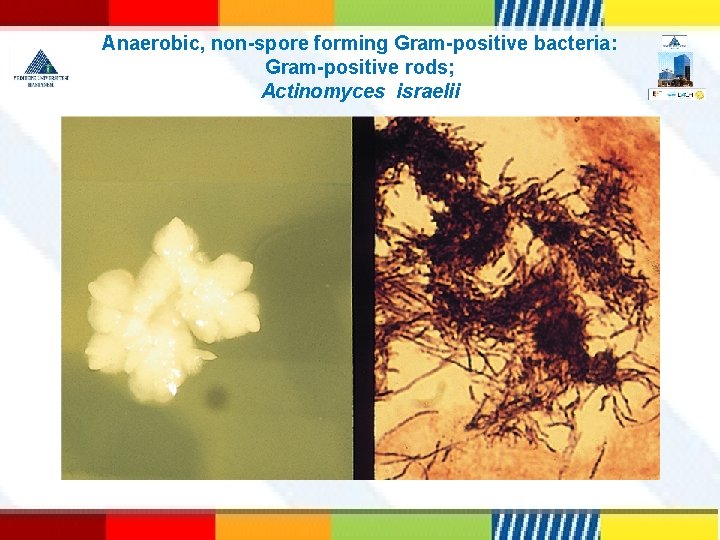 Anaerobic, non-spore forming Gram-positive bacteria: Gram-positive rods; Actinomyces israelii 