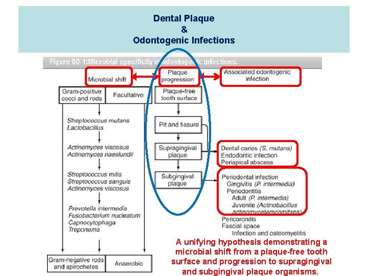 Dental Plaque & Odontogenic Infections A unifying hypothesis demonstrating a microbial shift from a