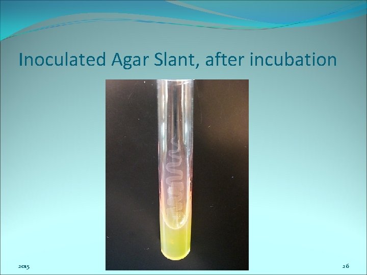 Inoculated Agar Slant, after incubation 2015 26 