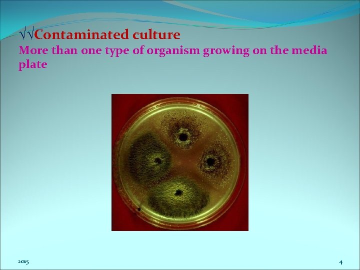 √√Contaminated culture More than one type of organism growing on the media plate 2015