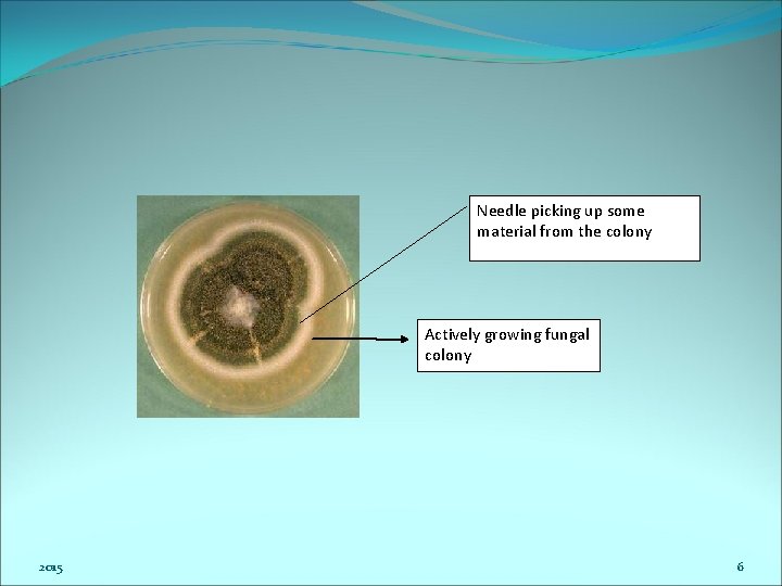Needle picking up some material from the colony Actively growing fungal colony 2015 6