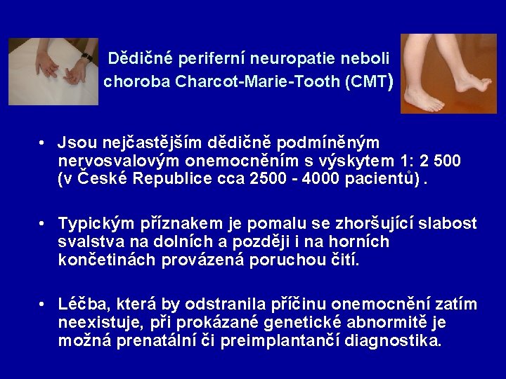 Dědičné periferní neuropatie neboli choroba Charcot-Marie-Tooth (CMT) • Jsou nejčastějším dědičně podmíněným nervosvalovým onemocněním