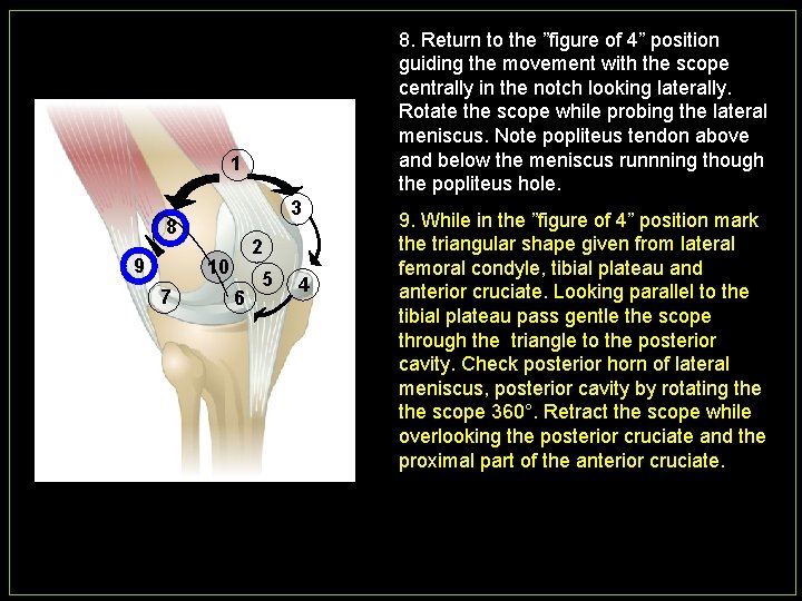 8. Return to the ”figure of 4” position guiding the movement with the scope