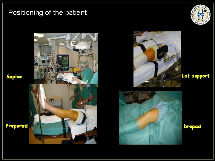 Positioning of the patient Supine Prepared Lat support Draped 