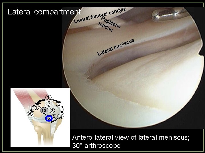 le Lateral compartment ndy o c l o. Pra m e f l a