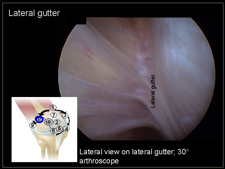 Lateral gutter 1 8 9 7 10 3 2 6 5 4 Lateral view