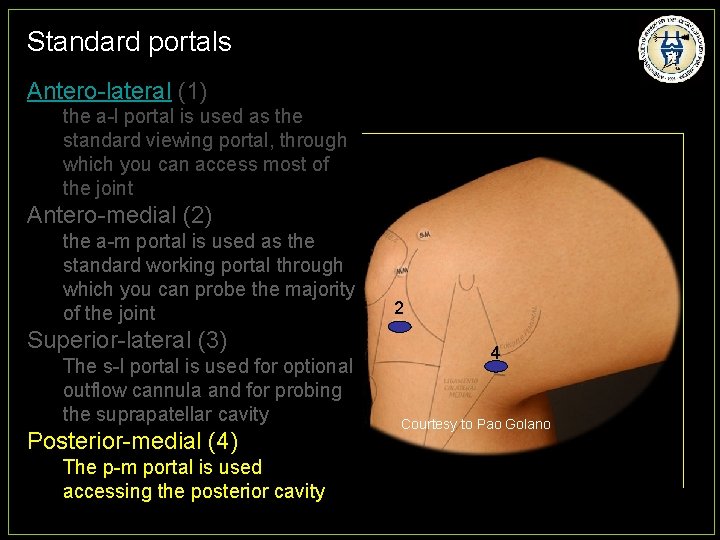 Standard portals Antero-lateral (1) the a-l portal is used as the standard viewing portal,