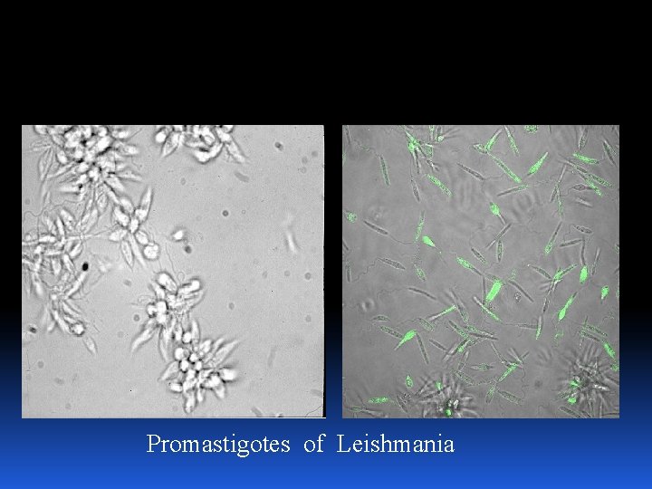 Promastigotes of Leishmania 