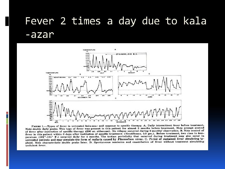 Fever 2 times a day due to kala -azar 