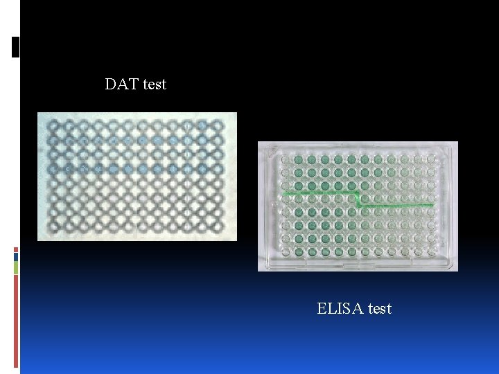 DAT test ELISA test 