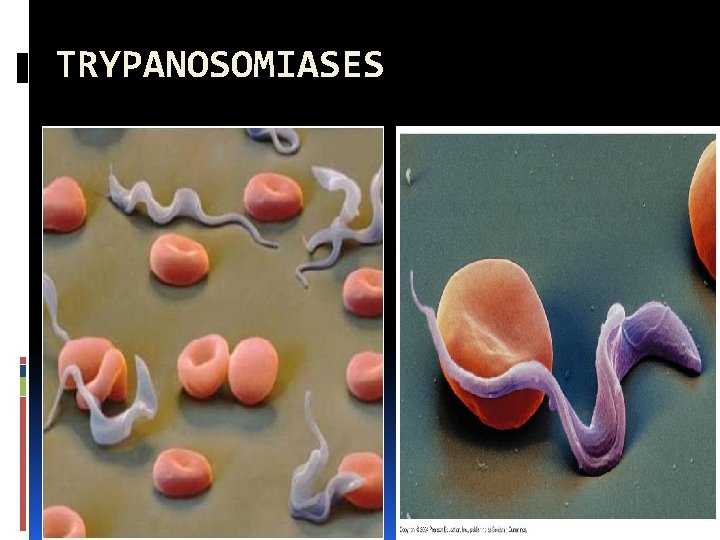 TRYPANOSOMIASES 