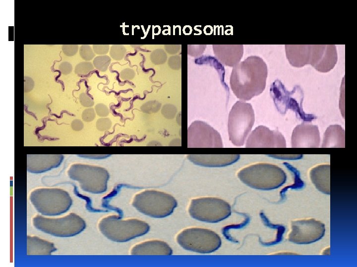 trypanosoma 