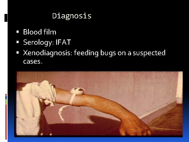 Diagnosis Blood film Serology: IFAT Xenodiagnosis: feeding bugs on a suspected cases. 