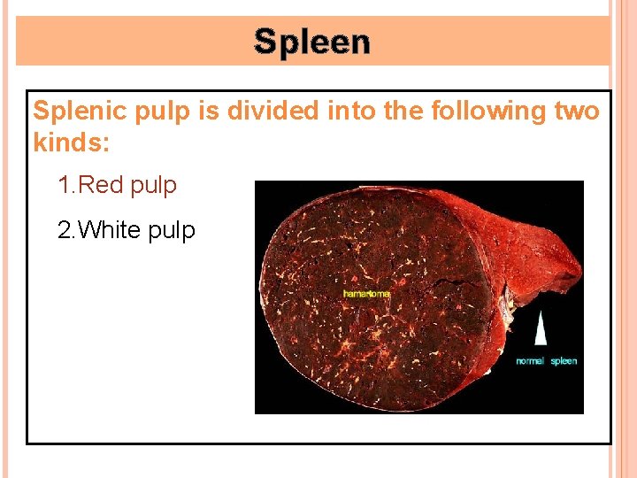Spleen Splenic pulp is divided into the following two kinds: 1. Red pulp 2.