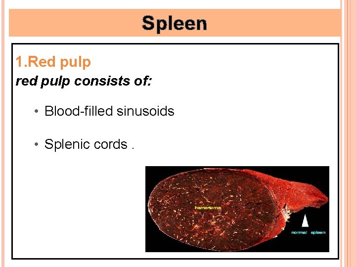 Spleen 1. Red pulp red pulp consists of: • Blood-filled sinusoids • Splenic cords.