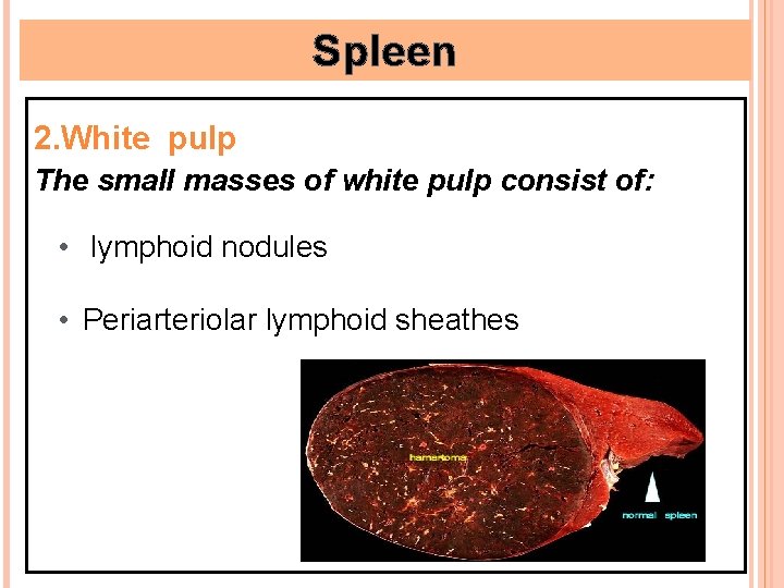 Spleen 2. White pulp The small masses of white pulp consist of: • lymphoid