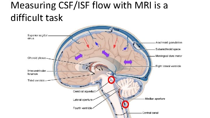 Measuring CSF/ISF flow with MRI is a difficult task 