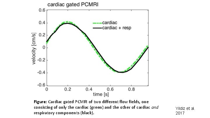 Figure: Cardiac gated PCMRI of two different flow fields, one consisting of only the