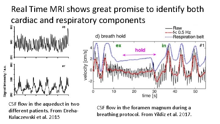 Real Time MRI shows great promise to identify both cardiac and respiratory components CSF