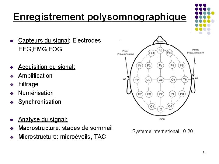 Enregistrement polysomnographique l Capteurs du signal: Electrodes EEG, EMG, EOG l Acquisition du signal: