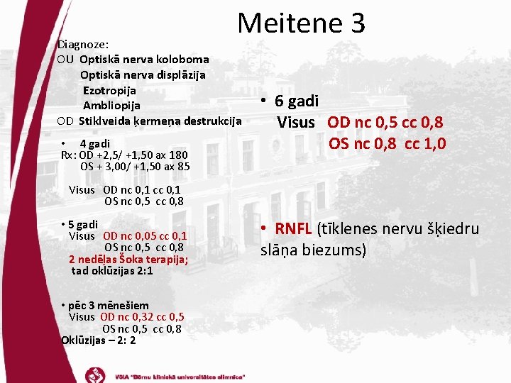 Meitene 3 Diagnoze: OU Optiskā nerva koloboma Optiskā nerva displāzija Ezotropija Ambliopija OD Stiklveida