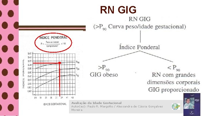 RN GIG Avaliação da Idade Gestacional Autor(es): Paulo R. Margotto / Alessandra de Cássia