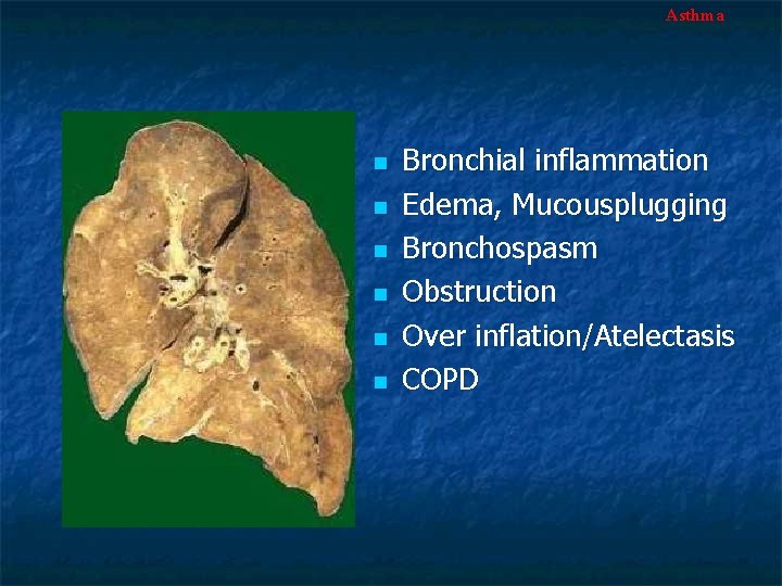 Asthma n n n Bronchial inflammation Edema, Mucousplugging Bronchospasm Obstruction Over inflation/Atelectasis COPD 