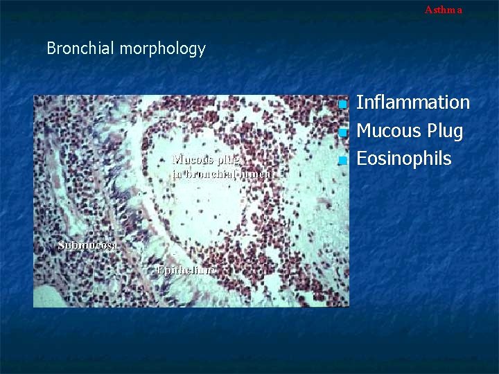 Asthma Bronchial morphology n n n Inflammation Mucous Plug Eosinophils 