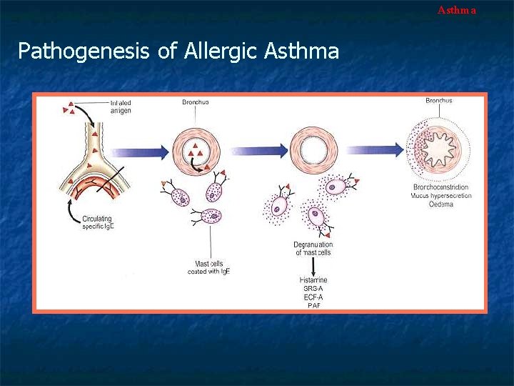 Asthma Pathogenesis of Allergic Asthma 