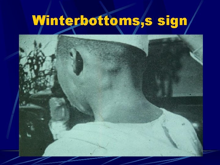 Winterbottoms, s sign 