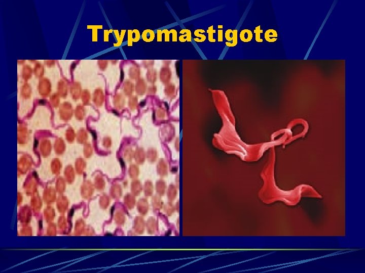 Trypomastigote Trypomastigote