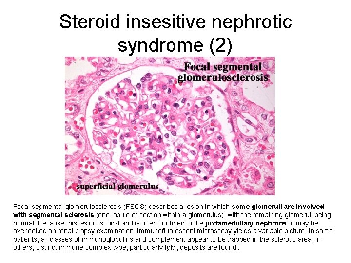 Steroid insesitive nephrotic syndrome (2) Focal segmental glomerulosclerosis (FSGS) describes a lesion in which