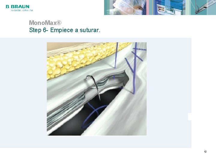 Mono. Max® Step 6 - Empiece a suturar. 12 