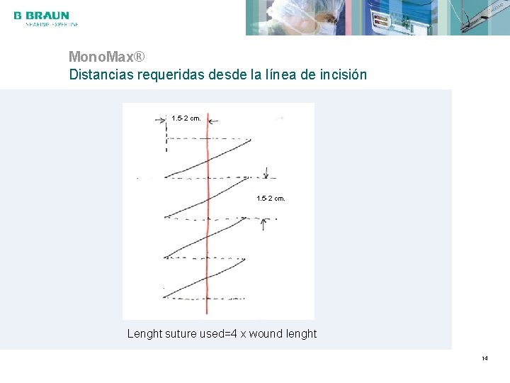 Mono. Max® Distancias requeridas desde la línea de incisión 1. 5 -2 cm. Lenght